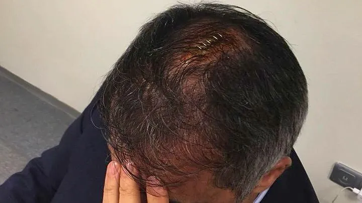 Άνοιξαν το κεφάλι προπονητή στο Σουκρού Σαράτσογλου