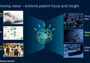 Watson, IBM
