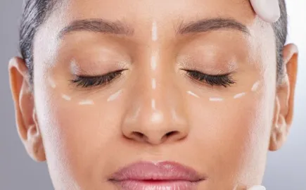 botox